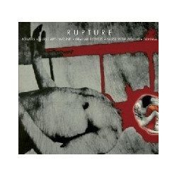 RUPTURE